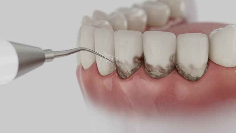 Trusted Teeth Cleaning And Checkup service in Weimar, TX - Dentist Open Now